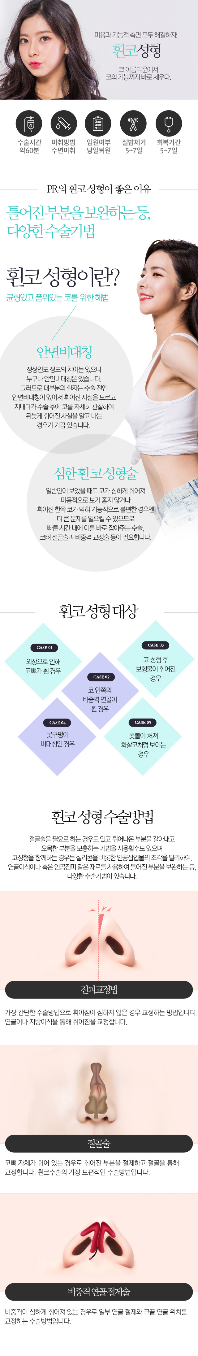 휜코교정