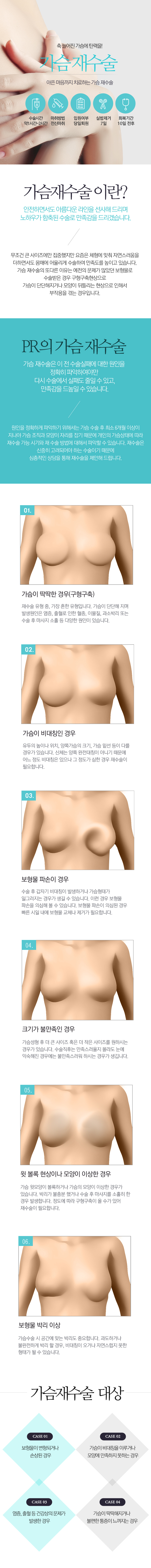 가슴재수술