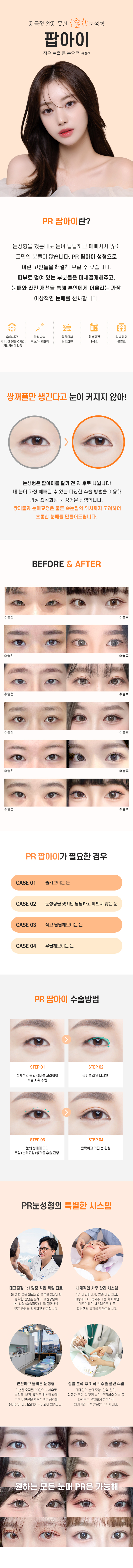 PR성형외과의특별함